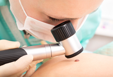 A doctor checking for Skin Cancer in Darwin