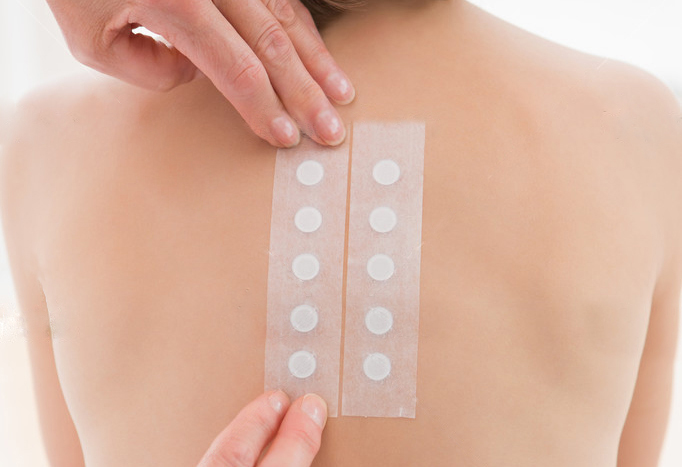 Patch allergy testing being performed in Darwin.